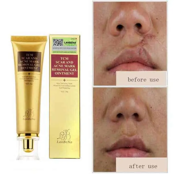 a91afe91b4eb4fbf8fbe9e8fd2ea3707 Crème anti-cicatrices et acné, pommade pour le visage TCM SCARAND
