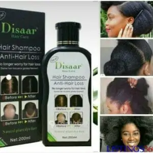 Champoing contre la alopécie, calvitie,chute des cheveux des cheveux