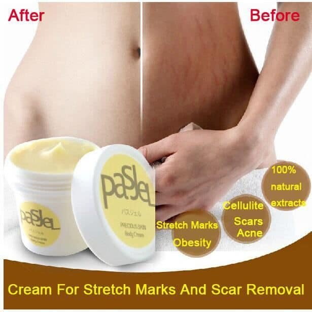 thailande peau precious creme corps vergetures rem thailande peau precious creme corps vergetures rem