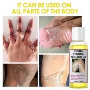 Peeling oil de traitement