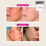 Crème de corps et visage faite à base de collagène et de bave d'escargot pour élimination des cicatrices d'acné, peau foncée , estompe les vergetures pour une peau bien hydrater,lisse et sans imperfections