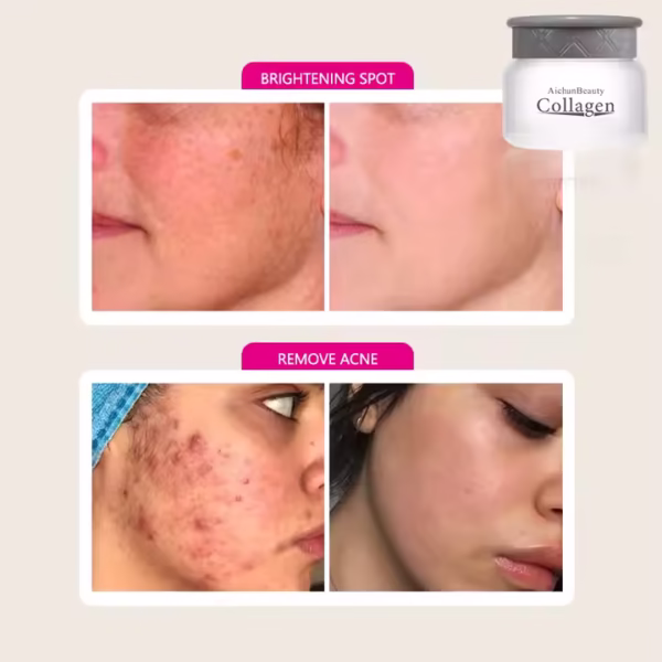 Crème de corps et visage faite à base de collagène et de bave d'escargot pour élimination des cicatrices d'acné, peau foncée , estompe les vergetures pour une peau bien hydrater,lisse et sans imperfections