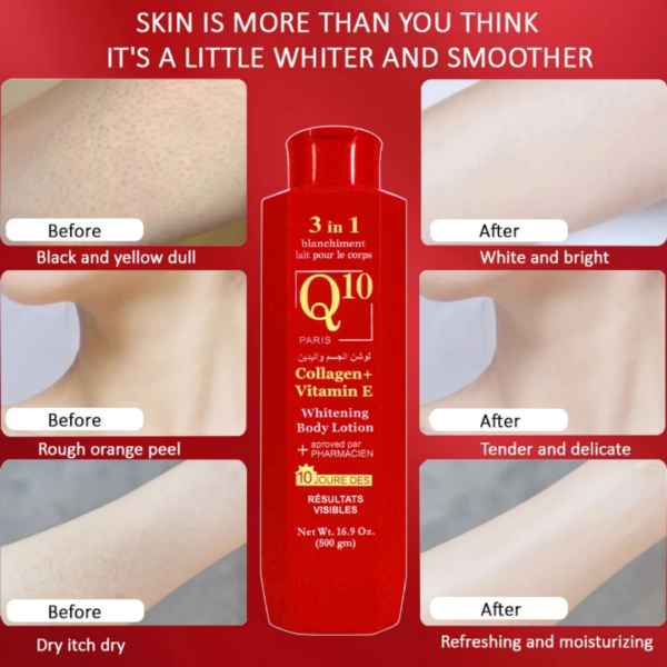 Lait corps Q10 pour une peau claire sans taches ni Quito estompe les vergetures