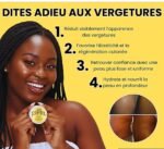 Crème pastel anti vergetures, acné bouton