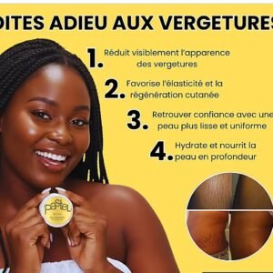 Crème pastel anti vergetures, acné bouton