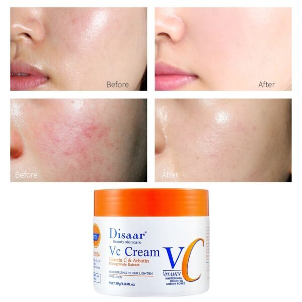 Crème Visage Disaar VC Vitamine C & Arbutine, Hydratante Réparatrice Anti-Taches, Anti-Rides et Resserre Pores pour un Teint Uniforme et Lumineux (120g)