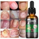 Sérum fortifiant réparateur pour ongles abîmé et infectés