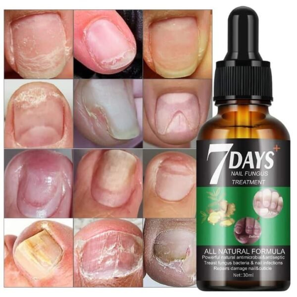 Sérum fortifiant réparateur pour ongles abîmé et infectés