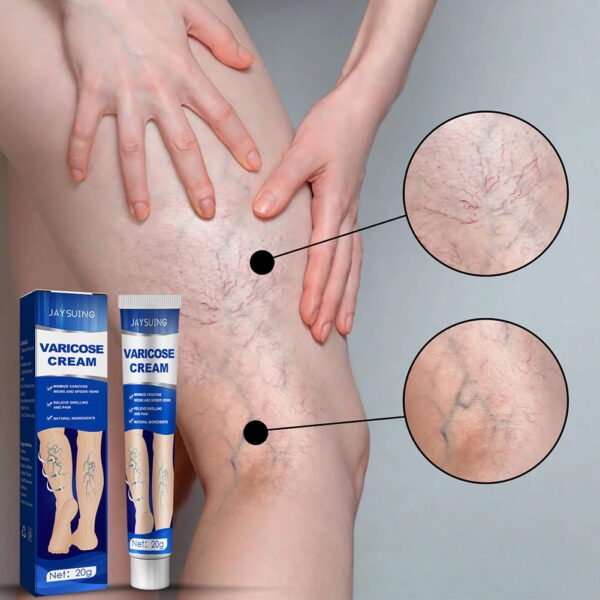 IMG 20260102 WA0048 Crème Traitement Varices et Veines Araignées, Soulagement Rapide Gonflement et Douleur, Amélioration Circulation Sanguine, Soin Jambes Lourdes et Fatiguées, Format 20g