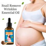 Huile Essentielle Anti-Vergetures 'The Snail' Aichun Beauty, Soin Réparateur et Régénérant pour Peau Lisse, Élimine et Réduit les Marques de Grossesse et Cicatrices, Formule 100% Naturelle à la Bave d'Escargot, 30ml