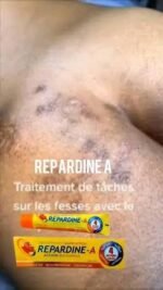 images (17)